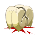 Dent de Chafer
